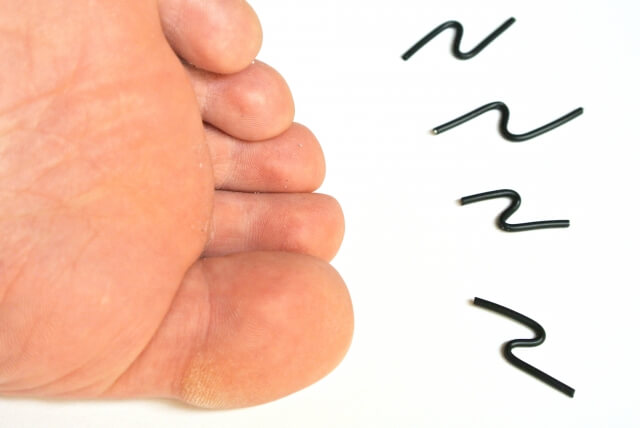指 しびれ の 足 指のしびれ：医師が考える原因と受診の目安｜症状辞典
